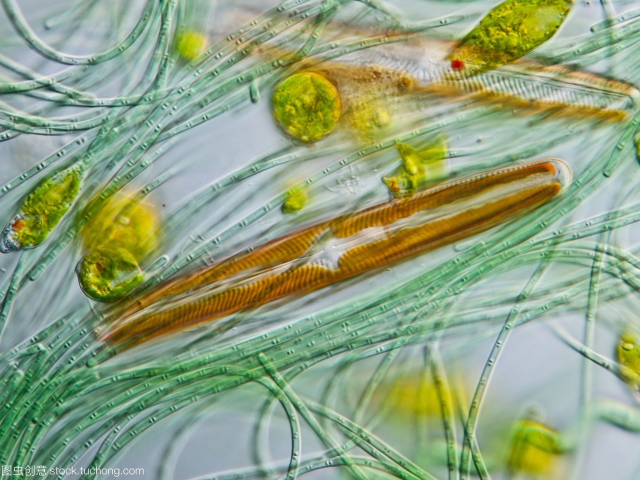 水塘藻类世界的微观探索 透过显微图辨识多样生命形态